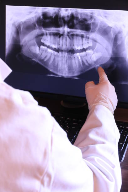 Best Emergency Dental Extractions in Bowmansville, PA